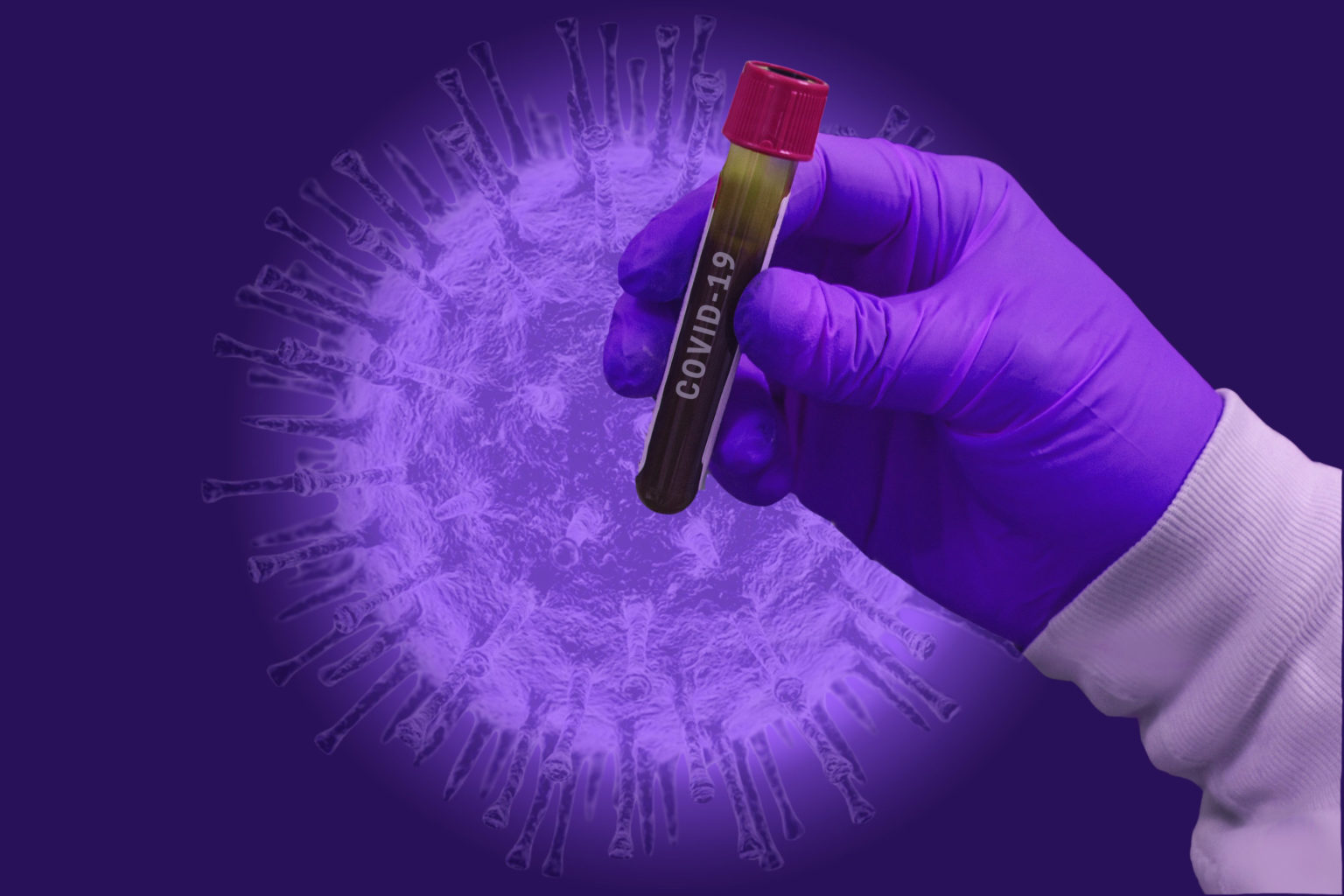 Der Kreis Meldet 76 Neue Coronaf lle Innerhalb Von 24 Stunden Davon 2